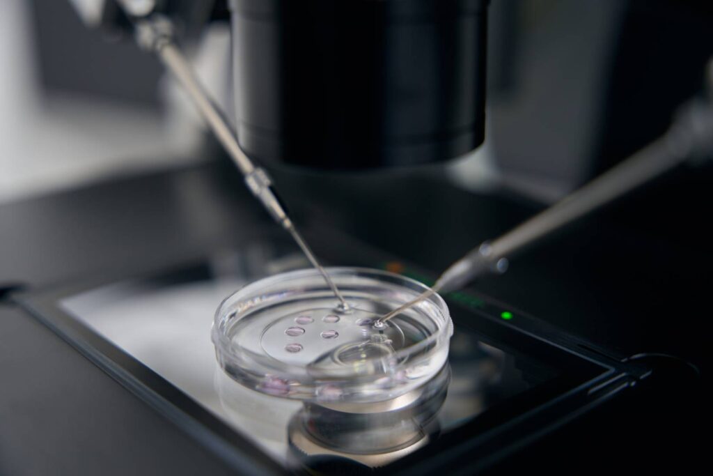 IVF Treatment in Lebanon
