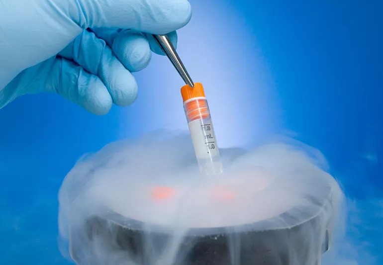 egg freezing