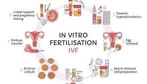 infertility specialist