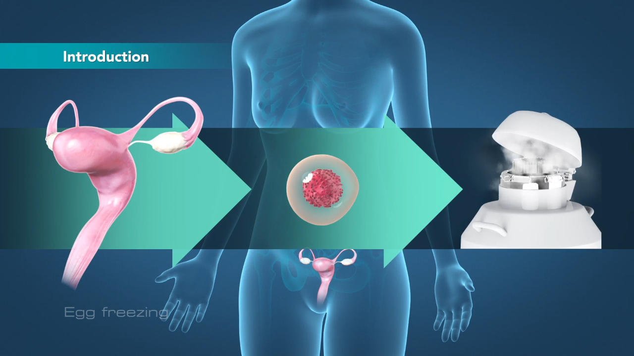 egg freezing lebanon