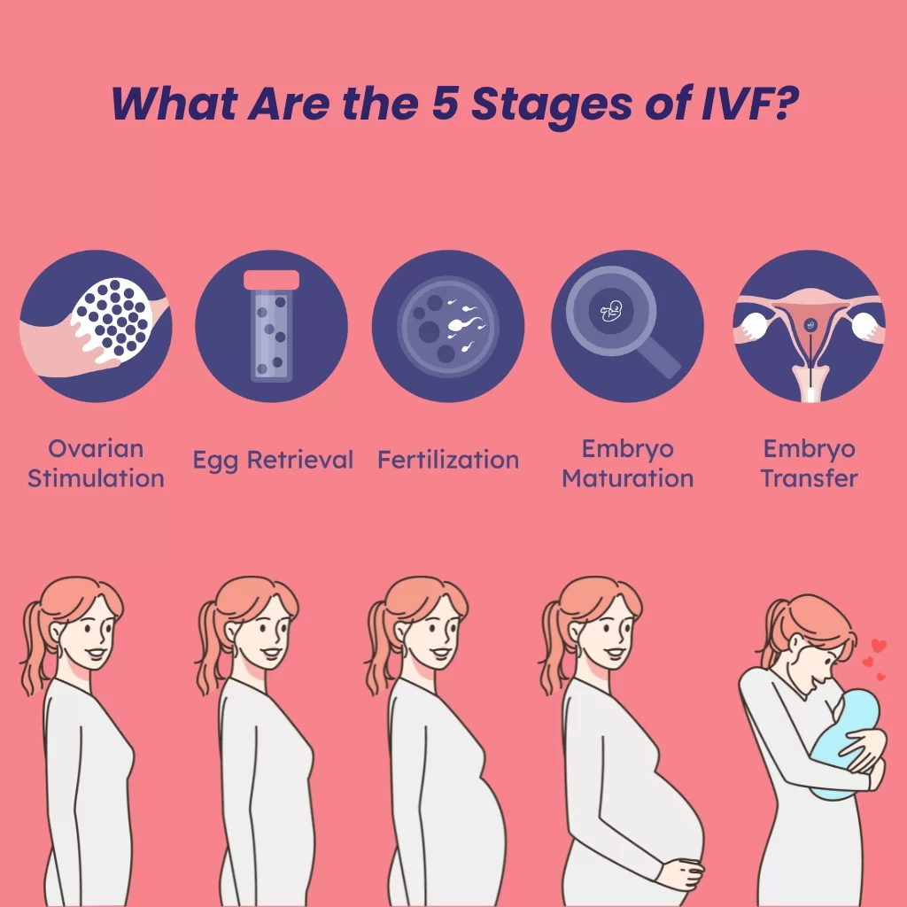 5 Stages of IVF